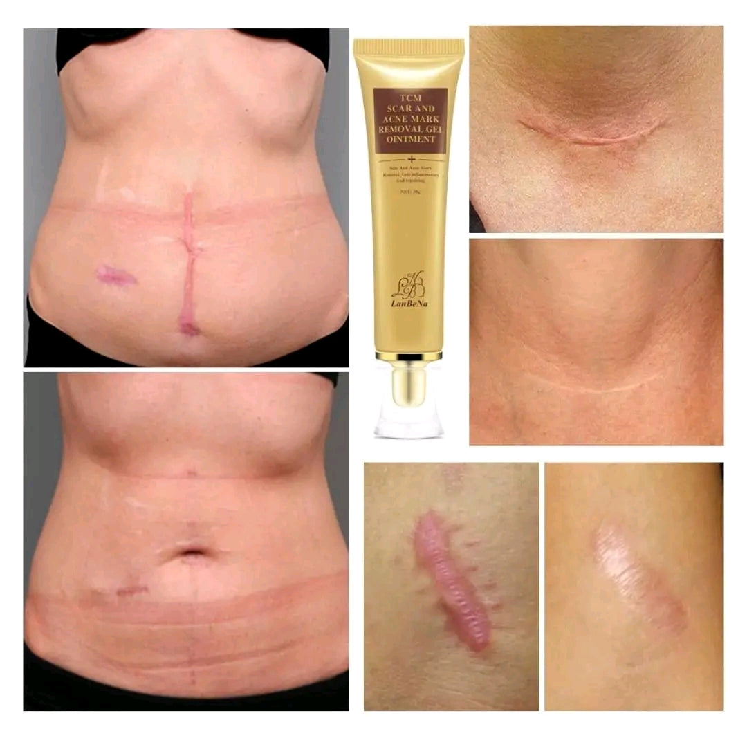 Crème Anti Cicatrice